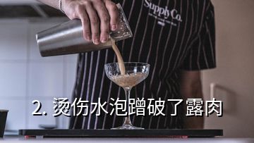 2. 燙傷水泡蹭破了露肉